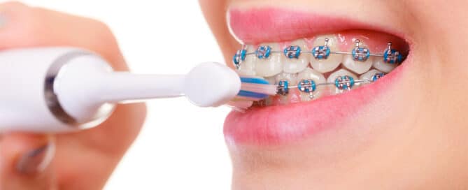 brushing teeth with braces