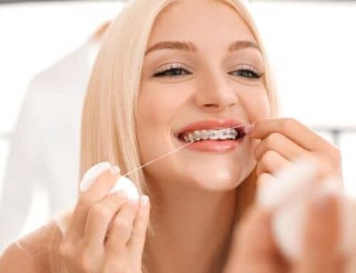 Flossing With Braces