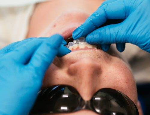 How Much Does Invisalign Cost in Richmond, VA?