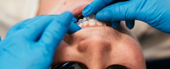 How much does Invisalign cost in Richmond, VA — RPDO orthodontist fitting a clear aligner tray for a patient at one of our Richmond-area offices