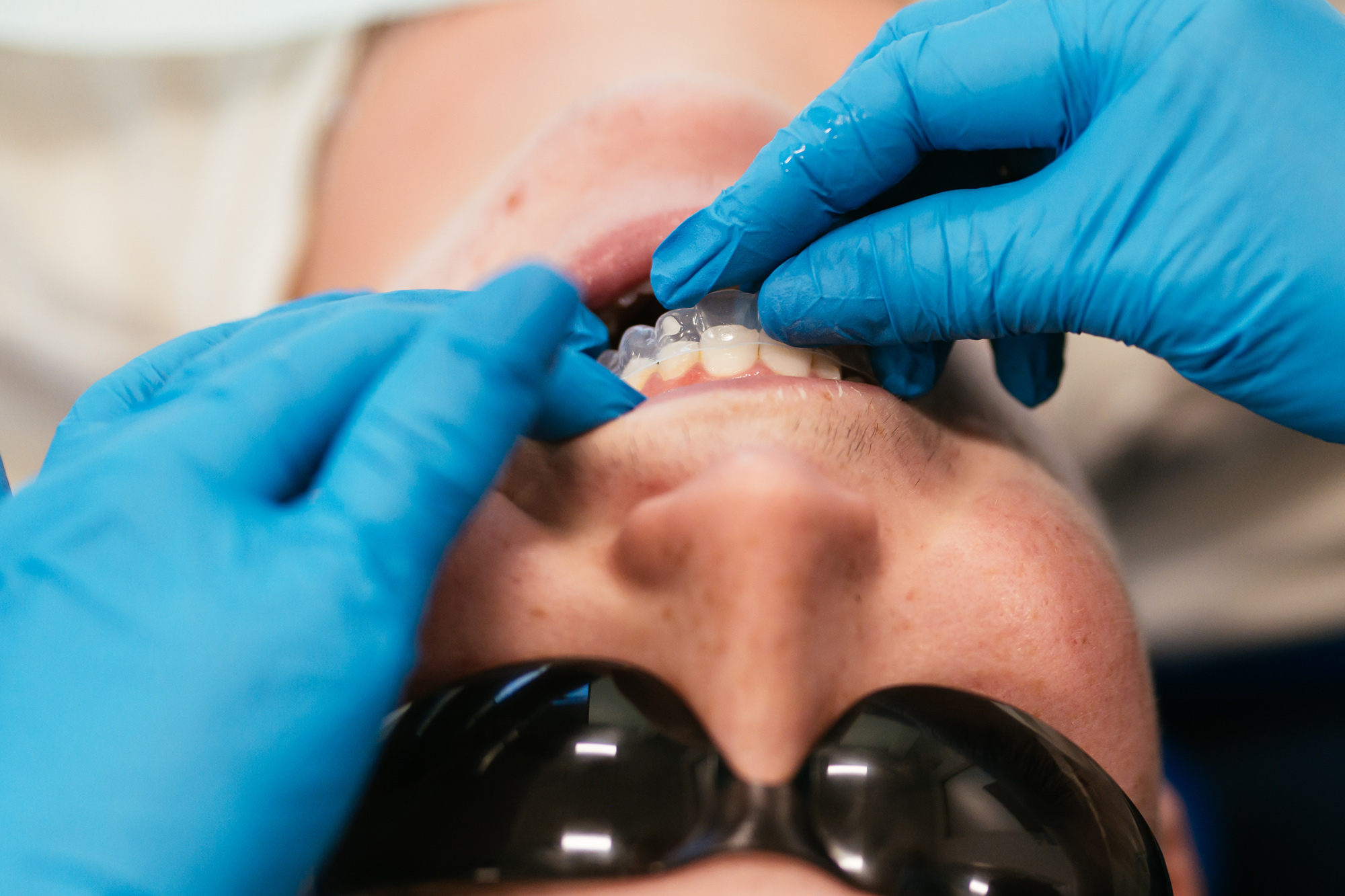 How much does Invisalign cost in Richmond, VA — RPDO orthodontist fitting a clear aligner tray for a patient at one of our Richmond-area offices