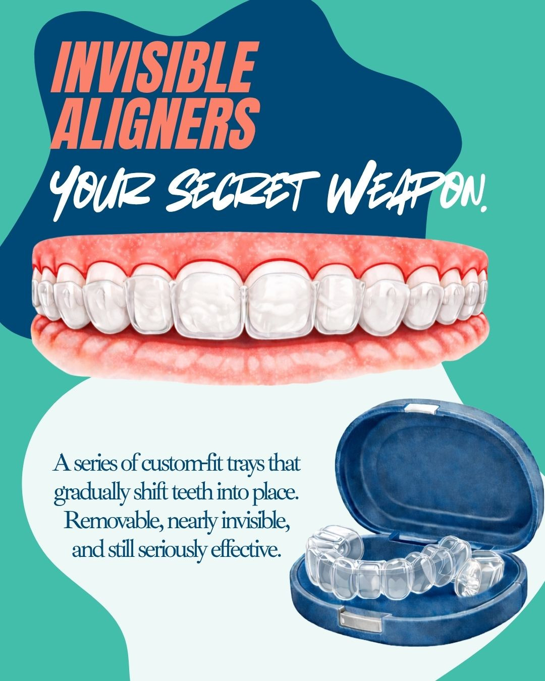 Invisalign clear aligners and carrying case — custom-fit trays that gradually shift teeth into place, available at RPDO in Richmond, VA