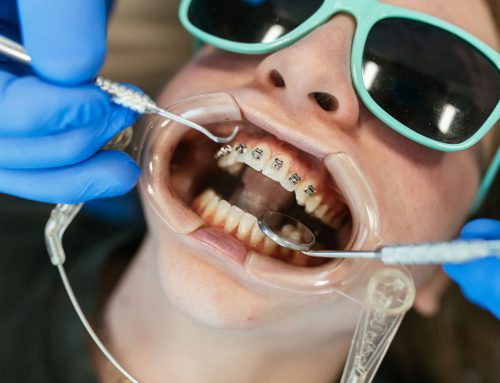 Do I Need Braces? An Honest Self-Check From a Richmond Orthodontist
